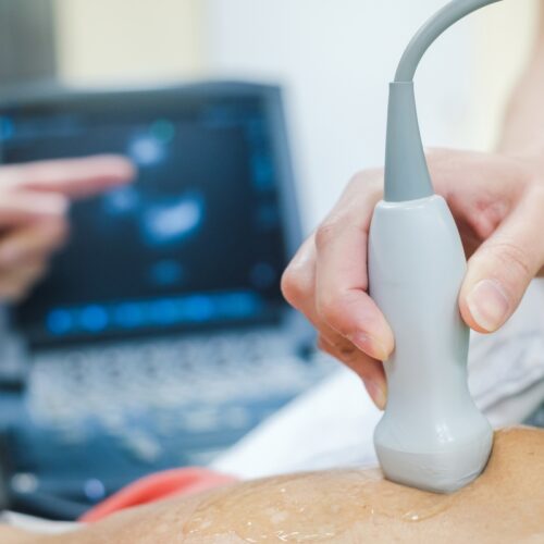 Exploring the Future of Medical Imaging: Portable Ultrasound