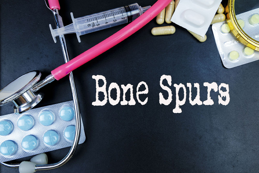 Bone Spurs &#8211; Causes, Types, and Management Options