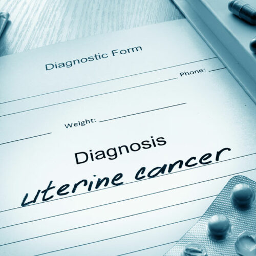 Uterine Cancer &#8211; Its Causes, Symptoms, and Stages