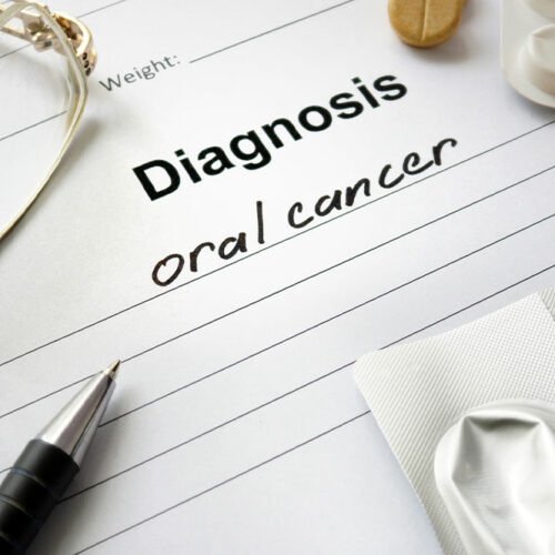 Oral Cancer &#8211; Symptoms, Causes and Management Options