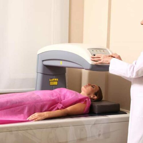 All You Need to Know About Bone Density Tests