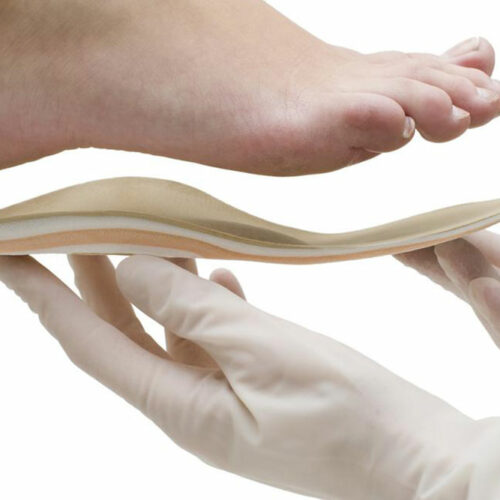 All you need to know about Orthotics