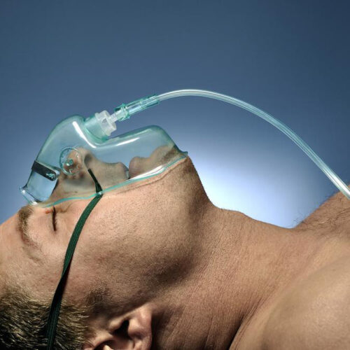 Application of oxygen therapy