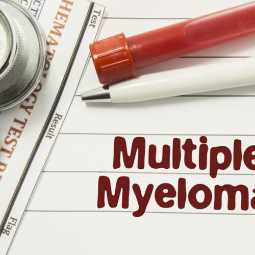 Common types of multiple myeloma and their treatments