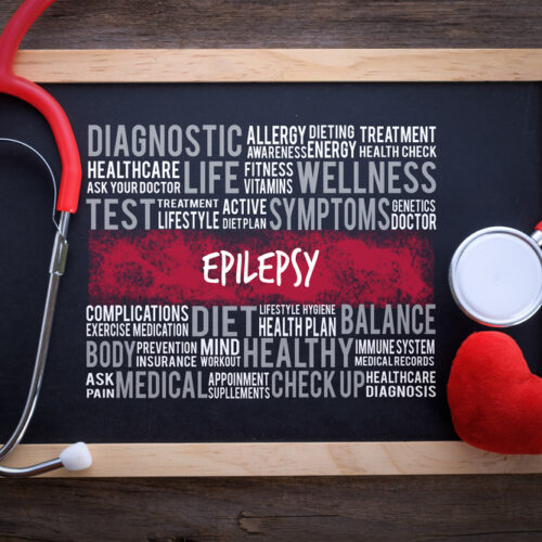 Epilepsy: 5 Common Signs and Symptoms