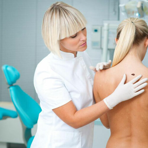 Here are a few common causes and symptoms of melanoma