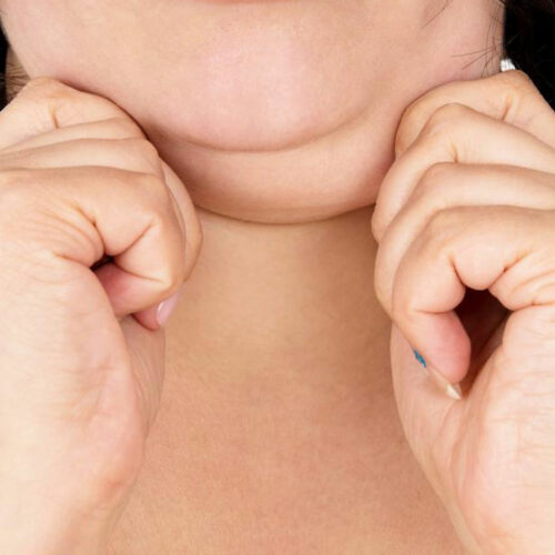 Struggling with a double chin? Here&#8217;s how you can get rid of it