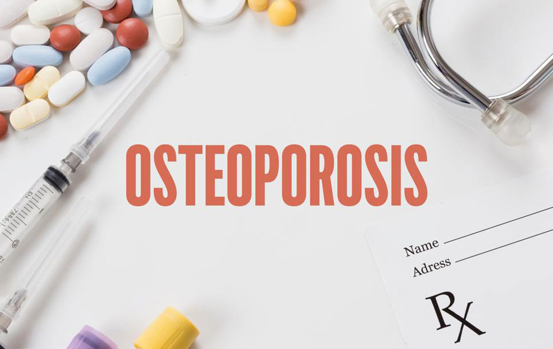 Ten steps to avoid or reverse osteoporosis