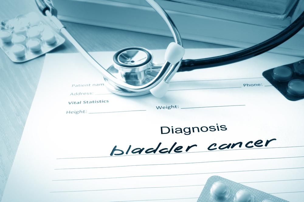 The Common Causes of Bladder Cancer