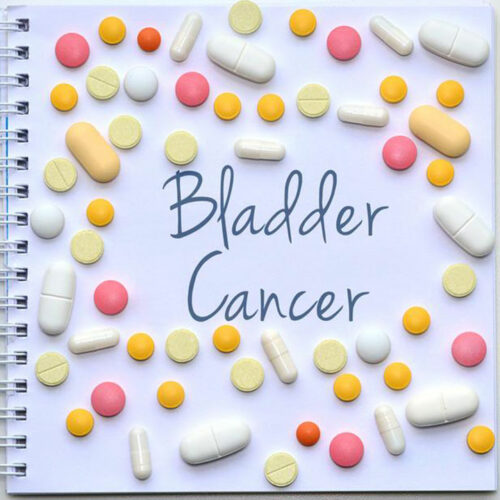 Things to know about the different stages of bladder cancer