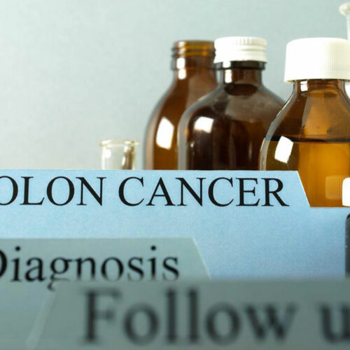 Things you need to know about colon cancer