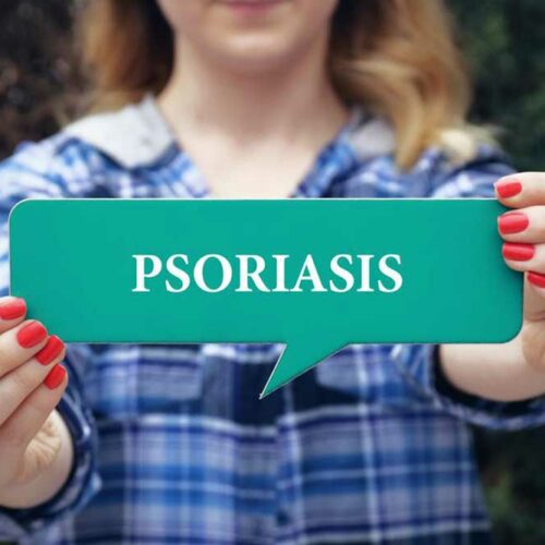 5 Ways to Treat Plaque Psoriasis at Home