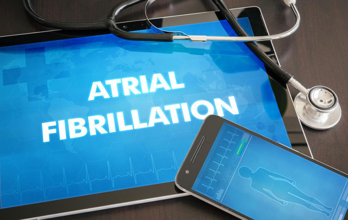 Atrial Fibrillation Treatment Options That Can Save Your Heart and Life