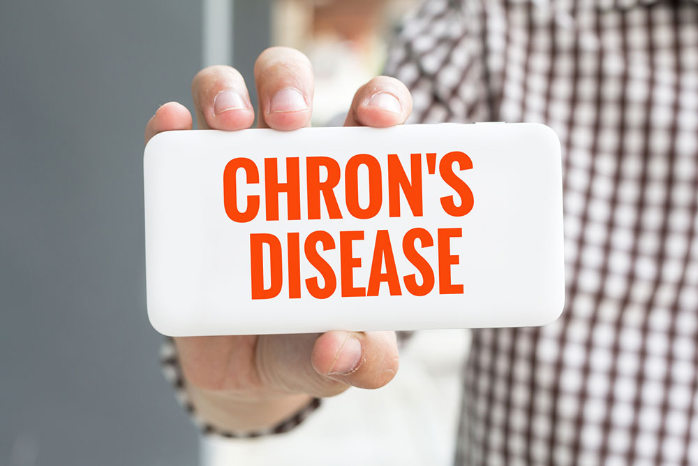 All You Need to Know about Chron&#8217;s disease