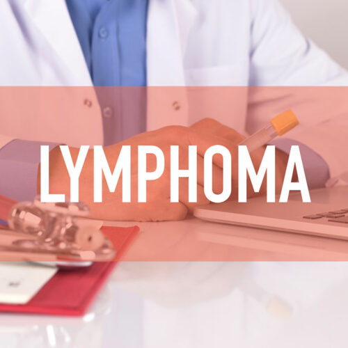 Common Causes, Risk Factors, and Symptoms of Lymphoma