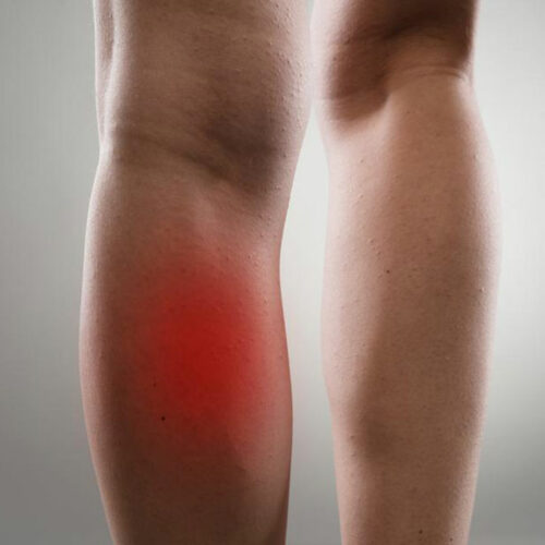 Common Causes and Treatments of Leg Muscle Pain