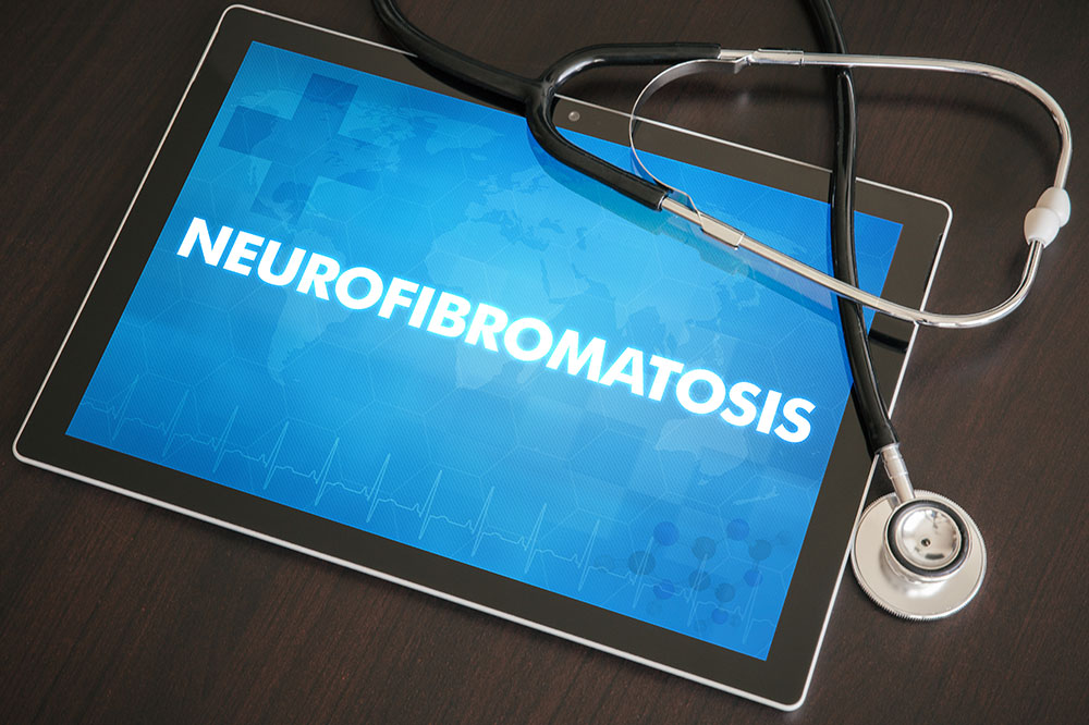 Doctor-recommended treatments for neurofibromatosis