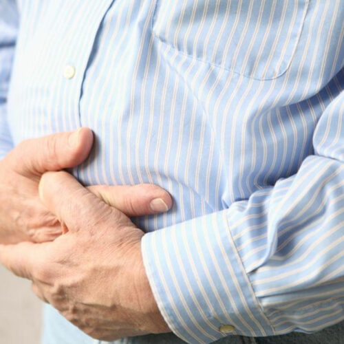 Essential Guidelines to manage Diverticulitis