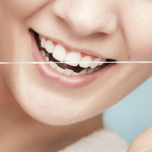 Healthy Dental Habits to Avoid and Remove Plaque