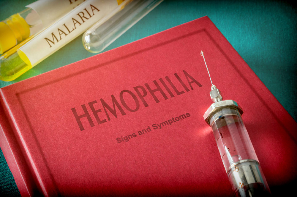 Hemophilia &#8211; Symptoms to look out for