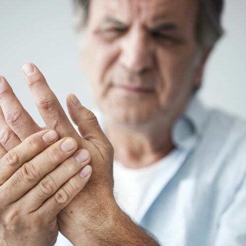 Home Remedies to Treat Rheumatoid Arthritis