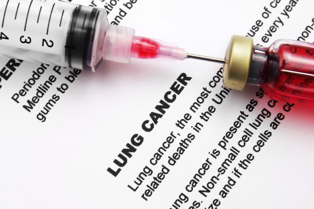 Remedies to Manage the Side Effects of Lung Cancer Treatments