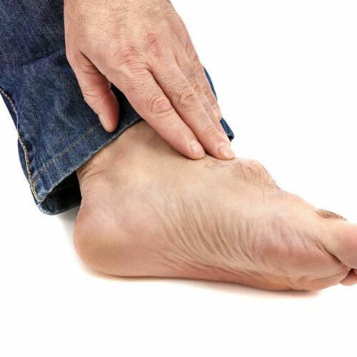 Symptoms, Causes, and Treatment of Gout