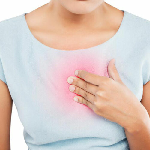 Symptoms of Heartburn and How to Treat It