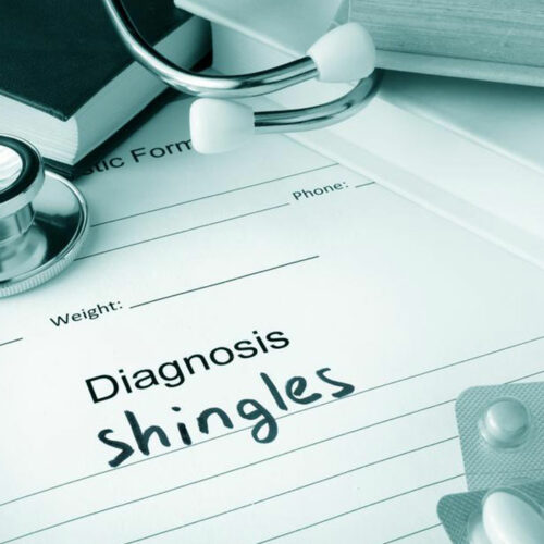 The Best Medication and Natural Treatments for Shingles