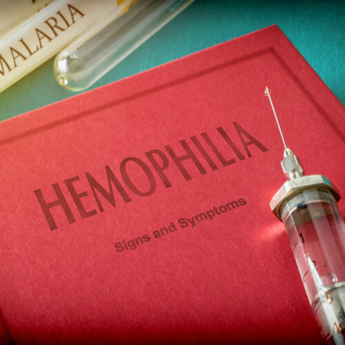 What are the symptoms of hemophilia