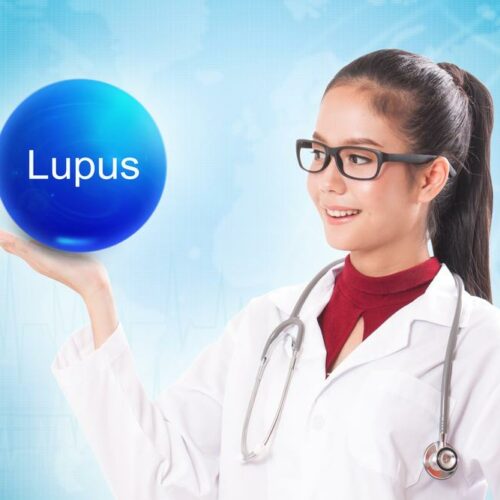 3 effective ways for living with lupus