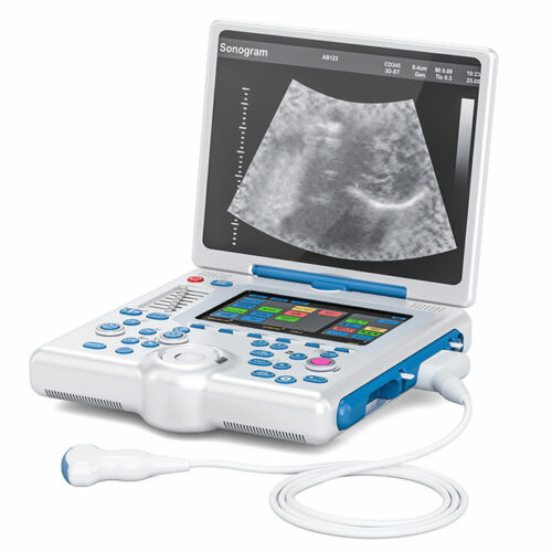 5 best portable ultrasound machines