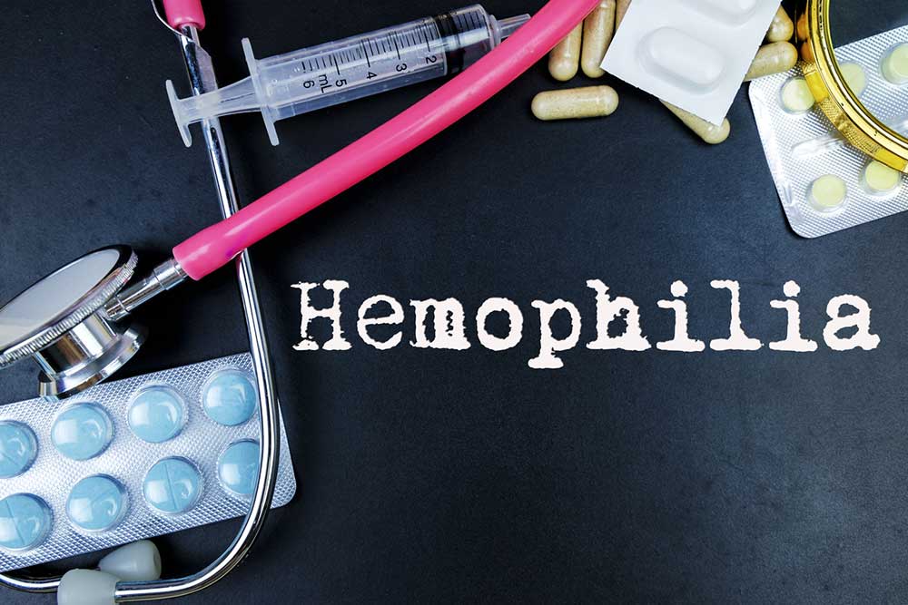 7 Common Ways to Treat Hemophilia