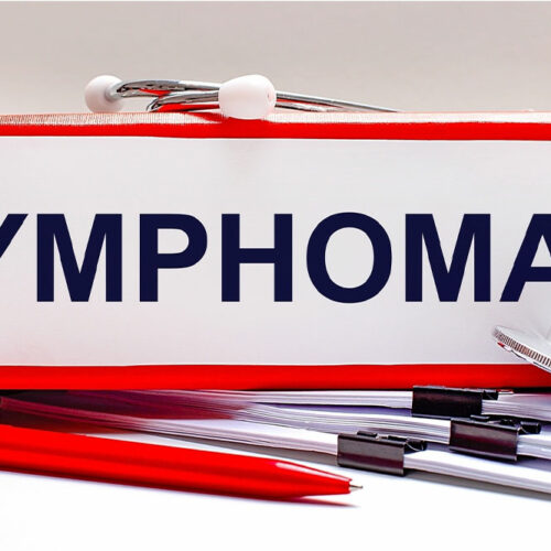 All you need to know about B-cell follicular lymphoma