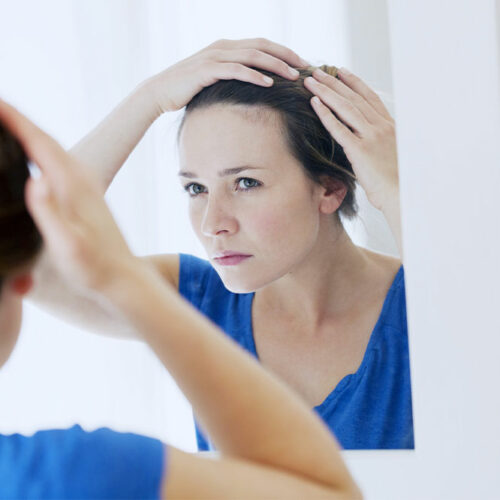 Effective Treatments to Prevent Hair Loss