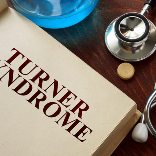 Turner Syndrome &#8211; Causes, Symptoms, and Management