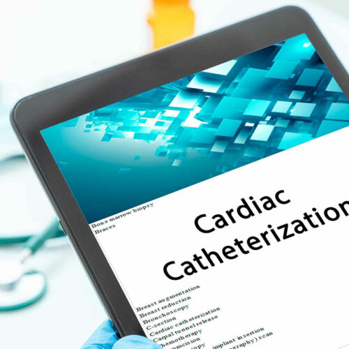 Everything to Know About Heart Catheterization Procedure